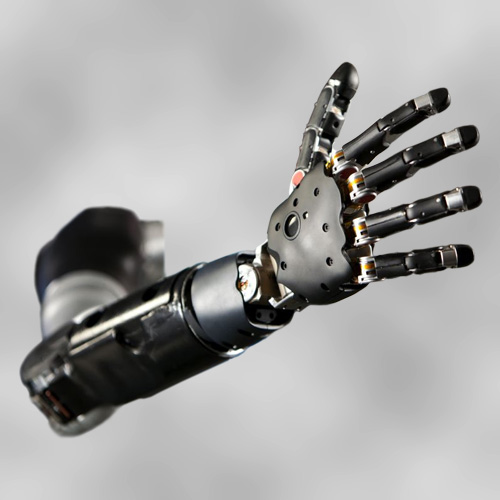 Prosthetic Arm